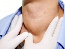 Ini Manfaat Lodine bagi Tubuh, Diantaranya Mencegah Gondok